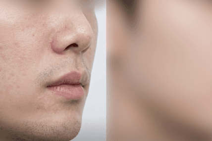 시술 전후 비교 예시